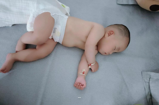 溧阳宝宝脸上有白色斑块